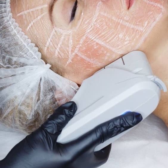 HIFU at Remake Beauty Studio Mcallen in McAllen, TX