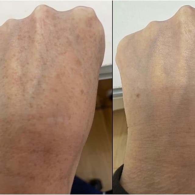 LUMECCA HANDS at Remake Beauty Studio Mcallen in McAllen, TX
